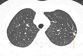 Trẻ bị cúm uống Tamiflu có an toàn?