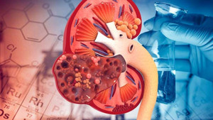 6 thói quen vào buổi sáng giúp bảo vệ thận