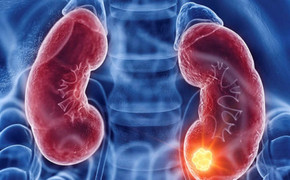 6 thói quen vào buổi sáng giúp bảo vệ thận