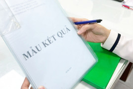 Bị trêu 'bé không giống bố', người đàn ông bí mật mang tóc con xét nghiệm ADN