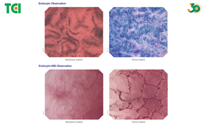Endocyto 520x: Khi nội soi tiến tới cấp độ tế bào