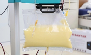 Mỡ máu cao gấp 20 lần, huyết tương đục như nước vo gạo