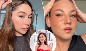 Trend làm đẹp gây sốt cả giới sao quốc tế: Nâng cơ mặt tức thì giá 0 đồng