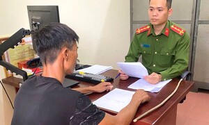 Xôn xao hình ảnh cháu bé bị bố đánh bầm tím chân tay: Công an vào cuộc làm rõ