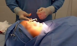 Thẩm mỹ ‘chui’ lộng hành, làm chết người: Trách nhiệm thuộc về ai?