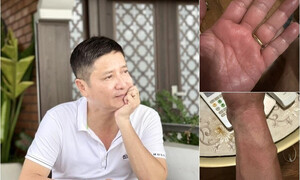 NSƯT Chí Trung mắc bệnh lạ, mất ngủ triền miên