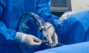 Vợ bác sĩ, chồng dược sĩ đi khám phát hiện cả hai thận ứ nước nặng