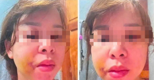 Người mẹ 3 con ở Đắk Lắk cầu cứu sau nhiều lần bị chồng hành hung