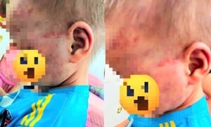 Lời khai của cha dượng vụ đánh con riêng 3 tuổi của vợ, khiến bé phải nhập viện