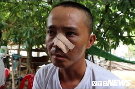 Ba cha con bị 20 người truy sát: Nạn nhân phẫn uất kể 3 trận đánh trong một buổi chiều