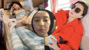 Phạm Băng Băng bị chảy máu mũi, sưng mặt không thể ăn uống