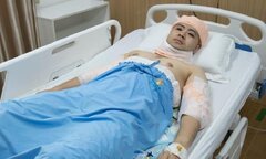 Akira Phan phẫu thuật thẩm mỹ sau khi bị chê xuống sắc, phát tướng