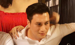 Hậu phẫu thuật thẩm mỹ, gương mặt Việt Anh bớt sưng nhưng vẫn lạ lẫm