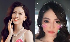 Bị nghi phẫu thuật thẩm mỹ, Á hậu Phương Nga nói gì?