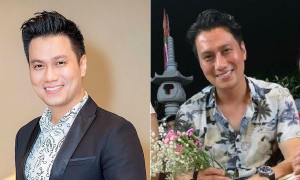 Ngỡ ngàng với gương mặt lạ lẫm của Việt Anh sau gần 2 tháng phẫu thuật thẩm mỹ