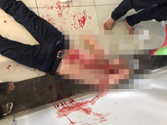 Côn đồ ngang nhiên xông vào chung cư truy sát chém người giữa ban ngày