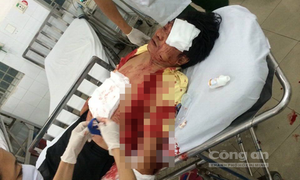 Côn đồ hung hãn trút ‘mưa dao’ lên tài xế taxi cướp tài sản