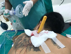 Thanh niên xăm trổ bị bạn gái vung dao đâm lút cán từ phía sau