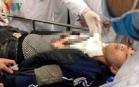 Giải quyết mâu thuẫn, nam sinh lớp 11 gọi anh rể đâm trọng thương bạn