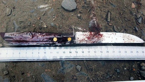 Đang chở hai con nhỏ, cha bị côn đồ truy sát, chém đứt gân tay