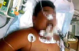 Dừng xe đi vệ sinh, người đàn ông bị truy đuổi, chém chết vì nghi trộm chó