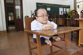 Cô bé nhiễm chất độc da cam từ chối đặc cách, quyết 'vượt vũ môn'