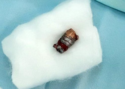 Đang xem đá gà, nam thanh niên bị bắn gục