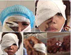 Thiếu uý tạt a xít vợ chưa cưới: Phải xử án điểm, nghiêm trị kẻ phạm tội dã man