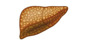 Loại nước 'thần' cực dễ làm giúp cơ thể thải độc, ngăn ngừa gan nhiễm mỡ