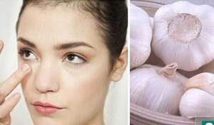 Những người tuyệt đối không nên ăn tỏi