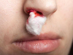 8 bệnh hiểm nghèo có thể gây chết người trong vòng 24h