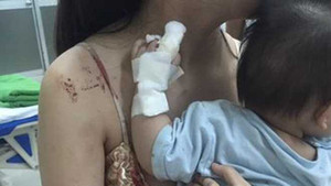 Điếng người thấy con bị chuột cắn nát tay, máu thấm đẫm ga giường