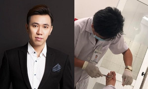 Cửa kính vỡ cứa vào chân, diễn viên hài Anh Đức phải khâu 20 mũi