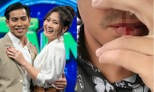 Bạn bè Thanh Bình lo lắng khi nam diễn viên bị chảy máu mũi bất thường