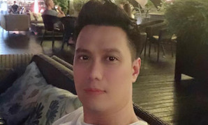 Bị chê phẫu thuật thẩm mỹ xấu, mặt sưng, Việt Anh nói gì?