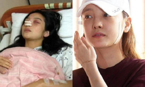 Những minh tinh Hàn Quốc từng bị chồng đánh đến mức phải nhập viện