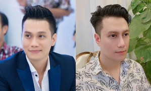 Gương mặt khác lạ sau khi phẫu thuật thẩm mỹ, Việt Anh sửa những gì?