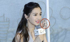 Angela Baby phải đeo nẹp ngón tay sau tai nạn quay show