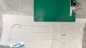 Thông tin mới về người đàn ông ăn sushi hàng ngày, mắc sán dây dài 1,67m