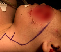 Bác sĩ BV Nhi đồng thốt lên 'kinh hoàng' vì quá nhiều bệnh nhi bị chó cắn