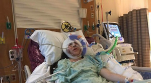 Tái tạo gương mặt và hộp sọ cho nữ luật sư bị biến dạng