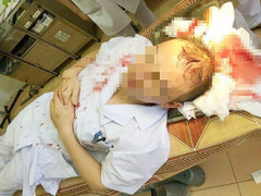 Hành hung, đánh trọng thương bác sĩ: Côn đồ hoành hành bất chấp đạo lý, nhân tính con người
