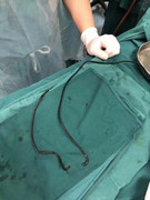 Dùng dây cáp dài gần 1m chọc vào ống niệu đạo để... gãi ngứa