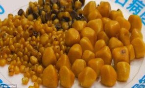 Nghiện đồ chiên rán, người phụ nữ nhập viện với gần 500 viên sỏi mật