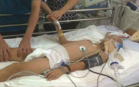 Té ngã khi leo cây, bé trai bị dập tủy sống, liệt hai tay