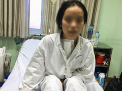 Khối u quái ác 'làm tổ' ở ngực trái hành hạ cô gái trẻ suốt 12 năm