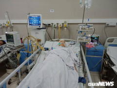 Nắng nóng gay gắt hoành hành miền Bắc, người phụ nữ tái phát bệnh cũ, chảy máu não hôn mê nguy kịch