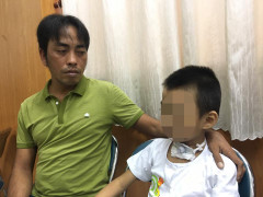 Cứu sống bé trai bị rơi từ độ cao 7m, rách nát vùng cổ