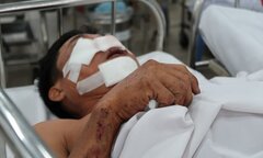 Lời kể của nạn nhân bị kẹp dính vào đầu xe sau tai nạn ở cao tốc Long Thành