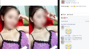 Thai phụ chết sau khi phẫu thuật nâng ngực: Xác định nguyên nhân bất ngờ